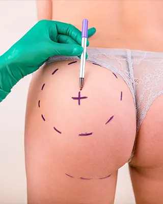 img-extraccion-de-biopolimeros-en-bogota-1-LCP