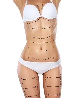 img-mommy-makeover-in-bogota-1-LCP